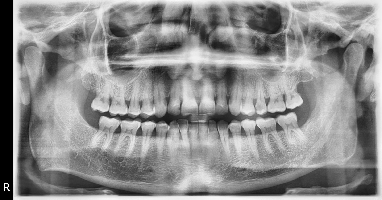 DVT-Evergreen-Dental