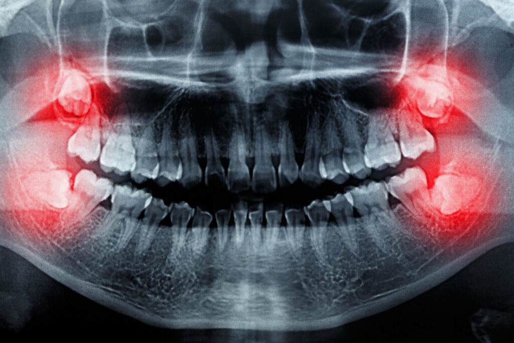 film X-Ray scan human